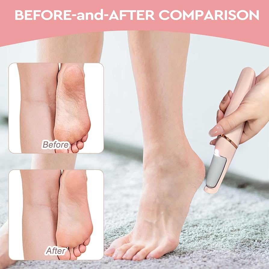 Electric Pedicure Foot File – Smooth, Salon-Quality Feet at Home 👣