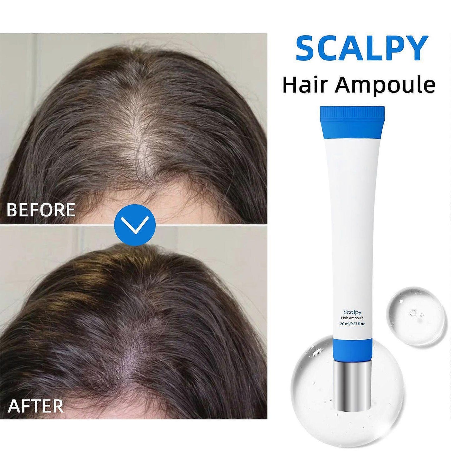 Orignal Scalp Hair Growth Serum – Nourish Roots, Boost Growth
