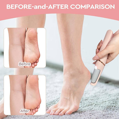 Electric Pedicure Foot File – Smooth, Salon-Quality Feet at Home 👣