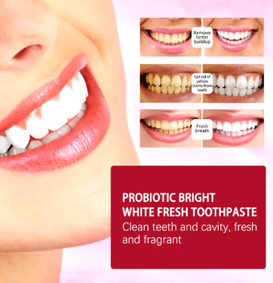 🦷 SP-4 Toothpaste (Original) – Complete Oral Care for a Healthy Smile